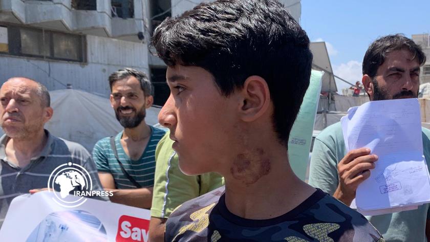 Iranpress: جرحى الحرب في غزة يطالبون بالسماح لهم بالسفر لتلقي العلاج